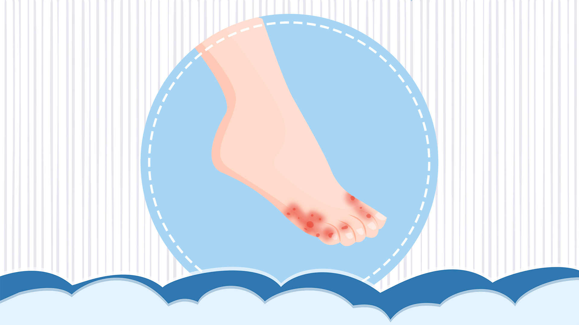 �ŵ���Ƥ������ô�� �ŵ���Ƥ��ԭ��